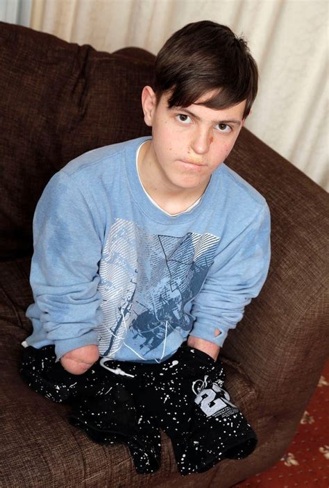Boy With No Arms And Legs Told To Prove Disability To Keep Government