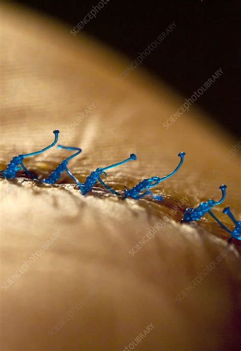 Surgical Sutures Stock Image C0119822 Science Photo Library