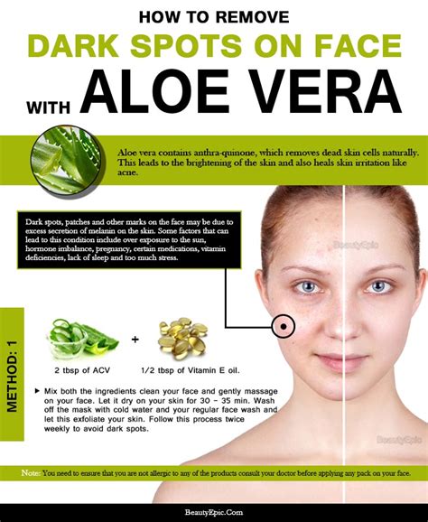 How to fade dark spots with ingredients you already have in your kitchen. How to Use Aloe Vera to Remove Dark Spots on Face