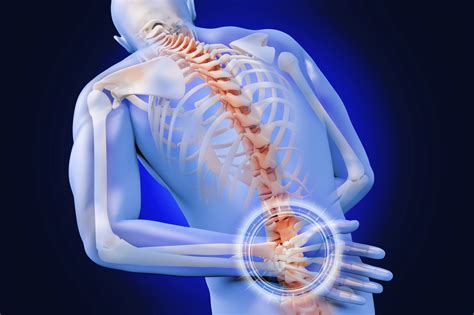 Lumbar Fusion What You Need To Know About This Back Surgery