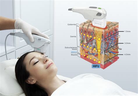 Hifu Plus High Intensity Focused Ultrasound Eha Skin Care