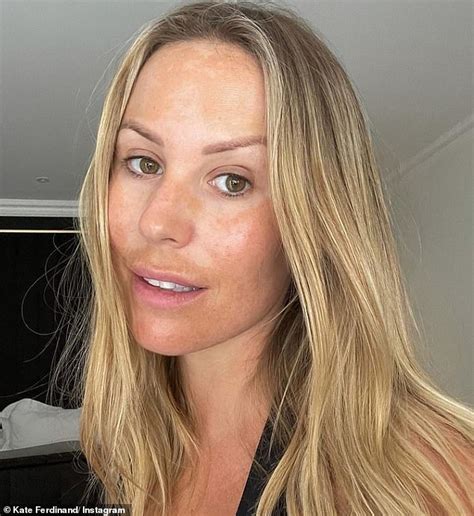 Kate Ferdinand Reveals Facial Pigmentation In Candid Bare Faced Photo