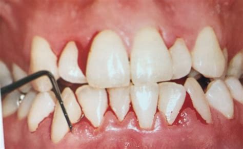 Edentswiss Parodontologia Edentswiss Studi Odontoiatrici