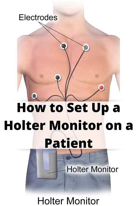 How To Set Up A Holter Monitor On A Patient In 2020 Holter Monitor