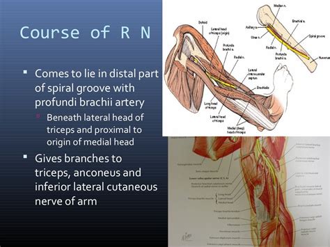 Radial Nerve Course And Relations Applied Anatomy