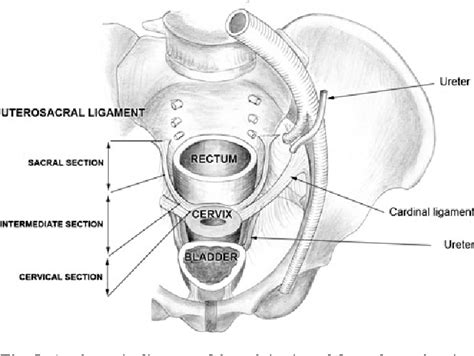Surgical Anatomy Of The Uterosacral Ligament Colpopexy Female Pelvic Sexiz Pix