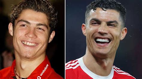 Cristiano Ronaldo Smile Transformation Before And After What Has The