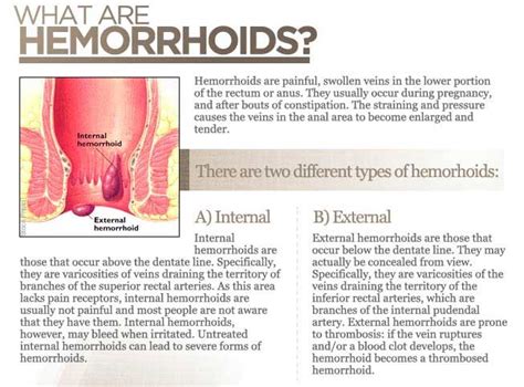 Venapro Uk Official Hemorrhoids Natural Treatment