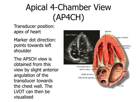 Ppt Introduction To Echocardiography Cardiac Ultrasound Powerpoint