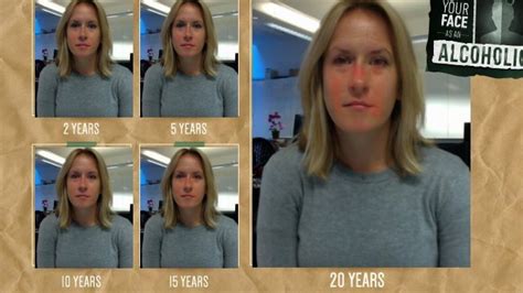 This Is What 20 Years Of Heavy Drinking Could Do To Your Face Huffpost Uk Life