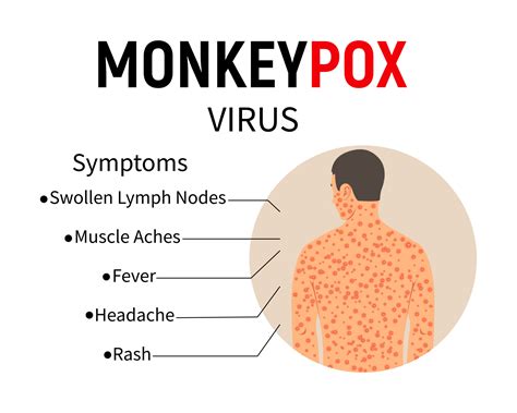 Symptoms Of Monkeypox Disease Infographic Text And Man With Rash And