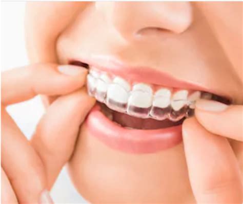 Invisalign Orthodontics Edgware Dental Practice