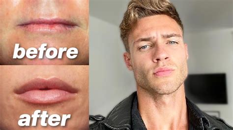 How To Get Bigger More Attractive Lips For Guys Youtube