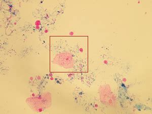 Interesting Findings Microscopic Analysis Of Urine Faculty Of