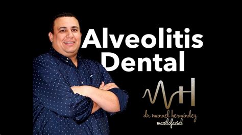¿cómo Evitar La Alveolitis Dental Youtube