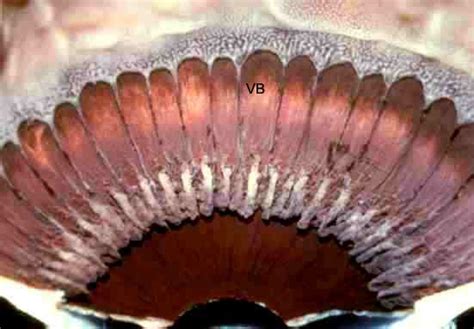 Anatomy Of The Human Eye Anatomy Of The Eye Vitreous Base