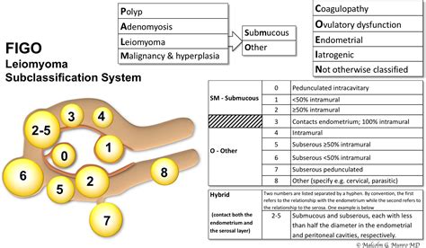 The Two Figo Systems For Normal And Abnormal Uterine Bleeding Symptoms And Classification Of