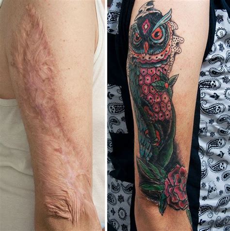 Scars Tattoo Cover Up Tattoo Over Scar Tattoos To Cover Scars Scar