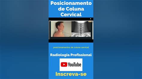 Posicionamento De Coluna Cervical Shorts Radiologiaporamor