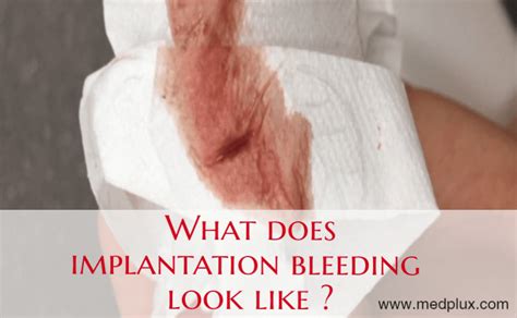 implantation bleeding on pad