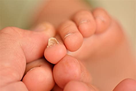 Since toenail fungus can be really hard to treat, especially in cases of people who have low immunity, home the oregano oil and coconut oil work well against the fungus due to their antifungal properties. Coconut Oil for Toenail Fungus: A Perfect Homemade Remedy ...