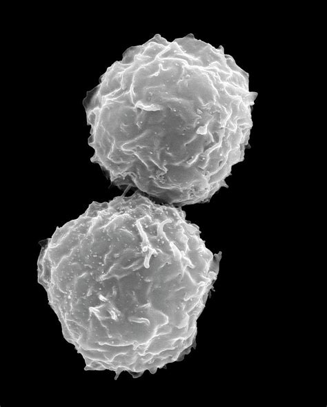Human Stem Cells From Bone Marrow Photograph By Dennis Kunkel