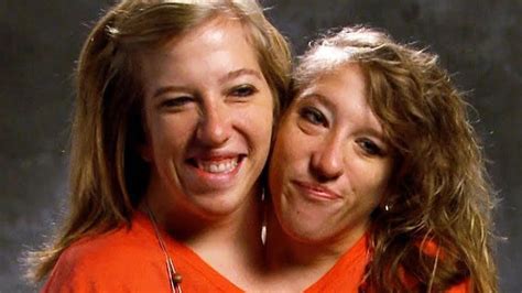 Conjoined Twins Abby And Brittany Hensel Where Are They Now
