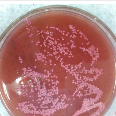 Characteristics Of Escherichia Coli On Sorbitol Macconkey Agar Note