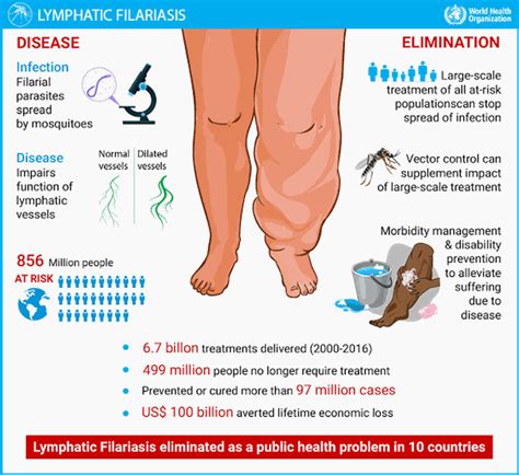 Filariasis Medizzy