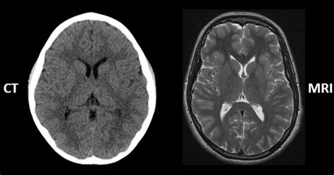 Medfriendly Medical Blog Ct Vs Mri Whats The Difference