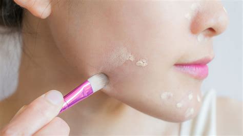 Hide Acne Scars With These Amazing And Easy Makeup Tips