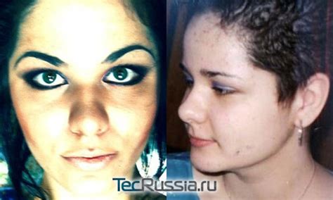 Кристина Рэй и ее самые большие в мире губы фото до и после пластических операций