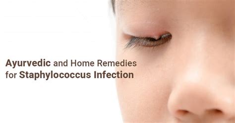Ayurvedic And Home Remedies For Staphylococcus Infection Nirogam