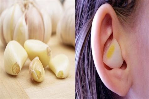 How To Cure 👂 Ear Infections Home Remedies
