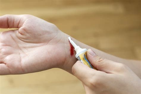 Rope burn, also known as friction burn, occurs when the skin rubs against a surface that can cause friction. How to Treat a Rope Burn (with Pictures) | eHow