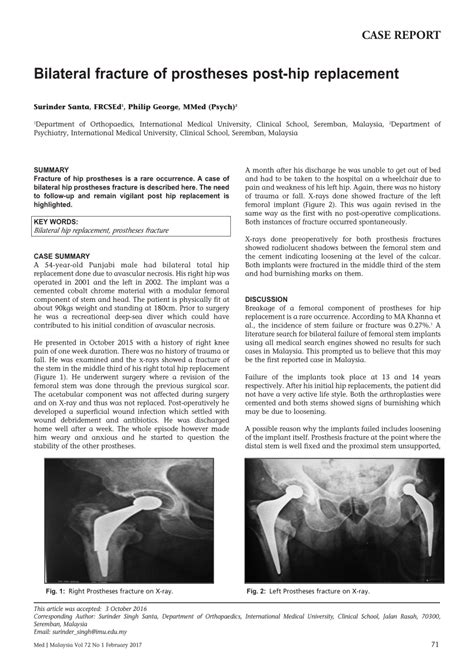 Pdf Bilateral Hip Replacement