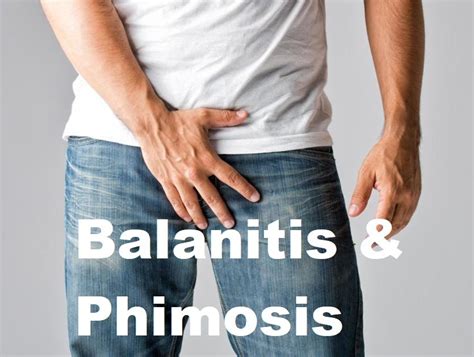 Balanitis And Phimosis In Diabetic Patients Klinik Dr Hasbi