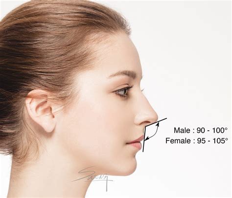 Facial Proportion Columellar Labial Angle Rhinoplasty Side View