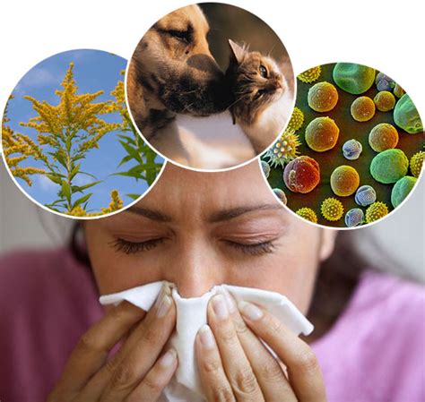 Symptoms Of Allergies Health And Personal Care