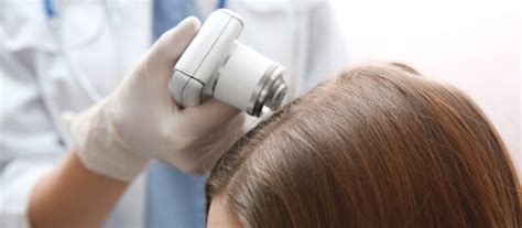 Posted By Hlrc On March 03 2020 Most Recommended Hair Loss Treatments