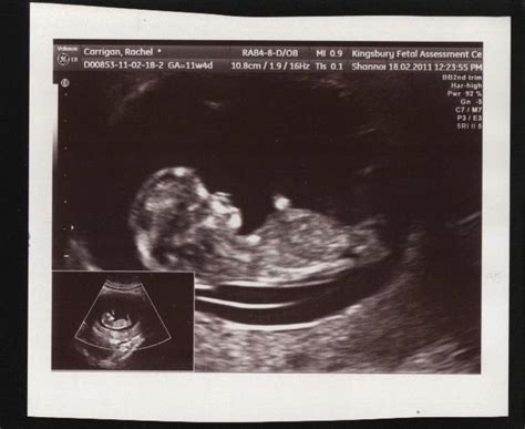 A pregnancy pillow is a great investment because it is useful not only during your pregnancy, but many women continue to use their pregnancy pillow long after they have given birth and their baby. 11 weeks 5 days pregnant symptoms gone, maternity insurance qatar, baby development in 8th month ...