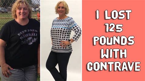 I Lost 125 Pounds With Contrave Youtube