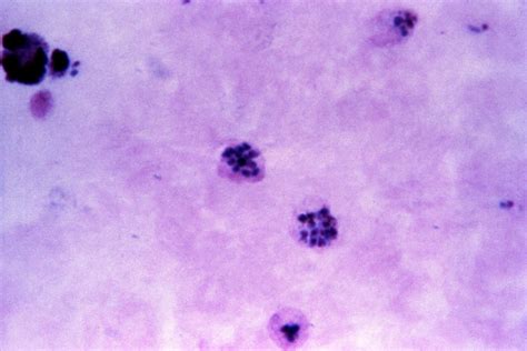 Imagen gratis micrografía plasmodium vivax esquizontes merozoitos