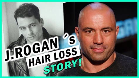 Joe Rogan Shaved His Head After 3 Hair Transplants Why Youtube