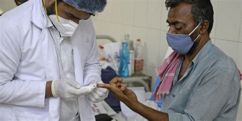 La mucormicosis, apodada hongo negro por los médicos en india, suele ser más grave en pacientes cuyo sistema inmunológico se encuentra debilitado por otra u otras infecciones. Qué es el hongo negro que da a pacientes de covid-19 en la ...