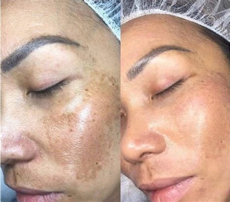 Bb Glow Para Que Serve