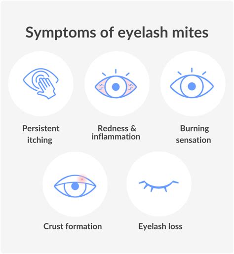 Eyelash Mites Symptoms Causes And Treatment Vision Direct Au