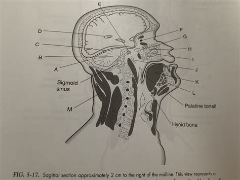 Fig 5 17 Sagittal Section Approximately 2 Cm To The Right Of The