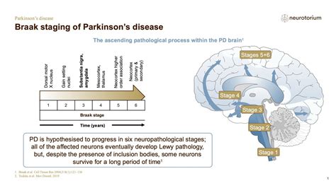 Non Motor Symptoms In Parkinsons Disease Implications For Our