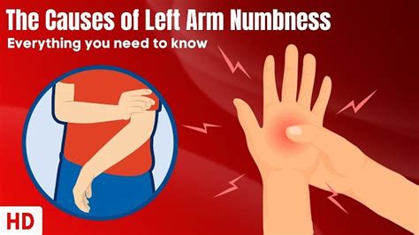 Can Anxiety Cause Pain In Left Arm Aljazeera Medical Center